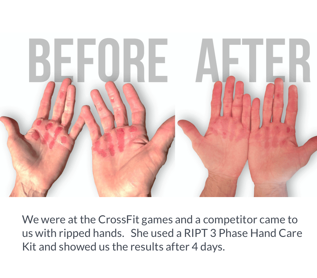RIPT hand care kit before and after photo