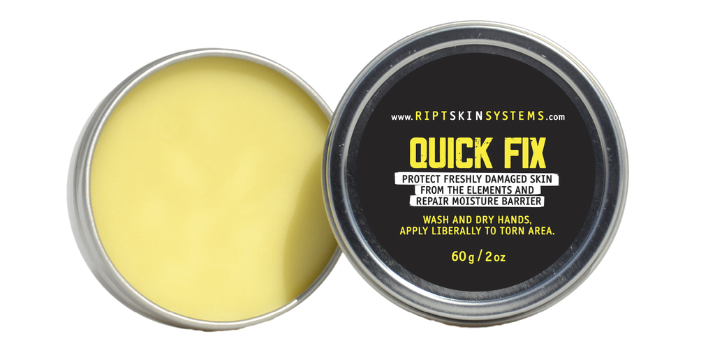 QUICK FIX - Mega Tin