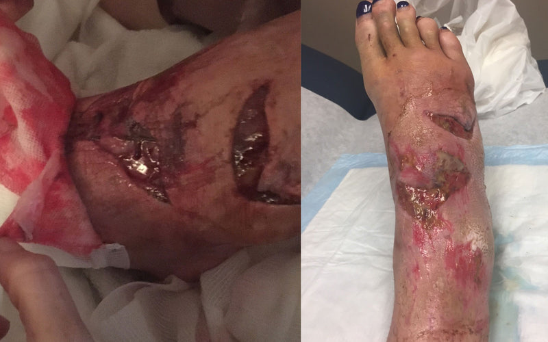 When you're in a car accident in Haiti....