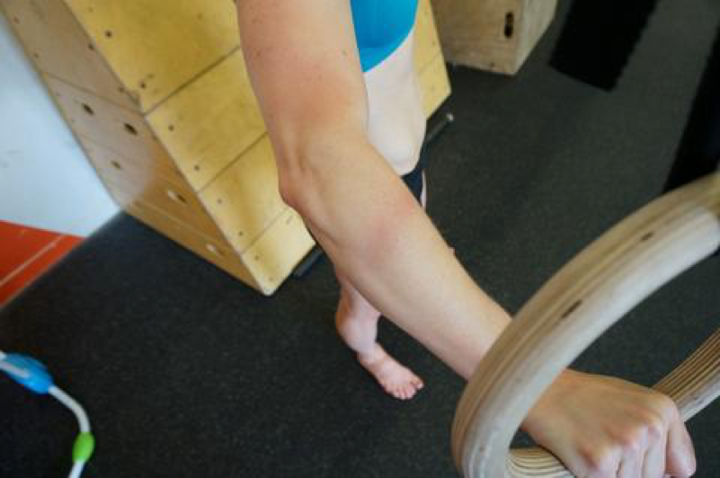 Do You Suffer From Ring Rash?