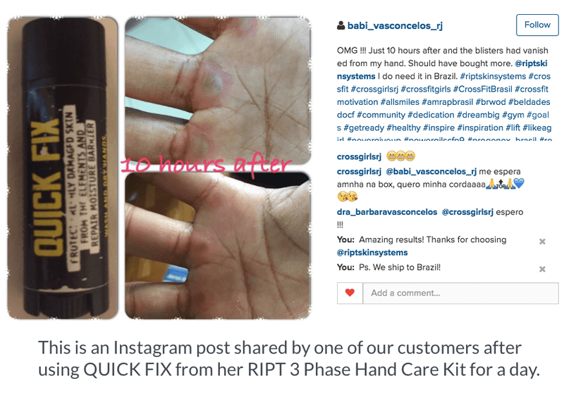 Hand Rip Treatment 3-Phase Hand Care Kit for Athletes | Prevent Rips & Heal Fast | RIPT ...