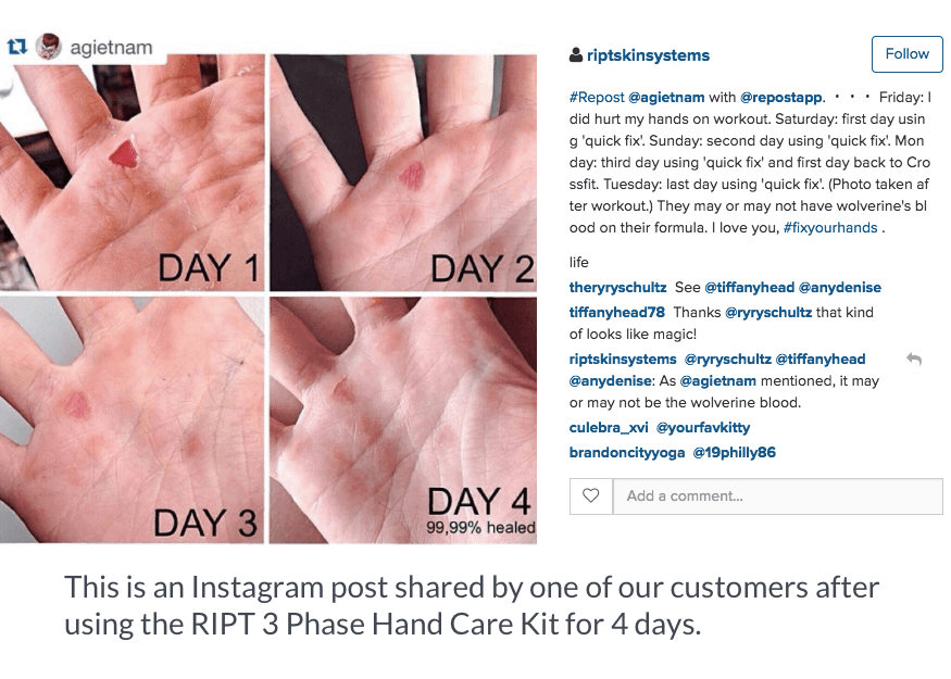 RIPT hand care kit 4 day results
