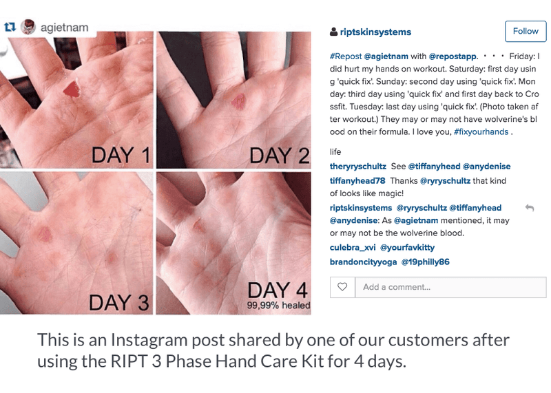 Hand Rip Treatment 3-Phase Hand Care Kit for Athletes | Prevent Rips & Heal Fast | RIPT ...